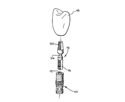 Bendable adapter for dental implant