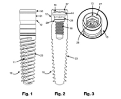 Dual Function Dental Implants