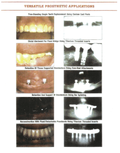 Core-Vent Versatile
      Prosthetics Application